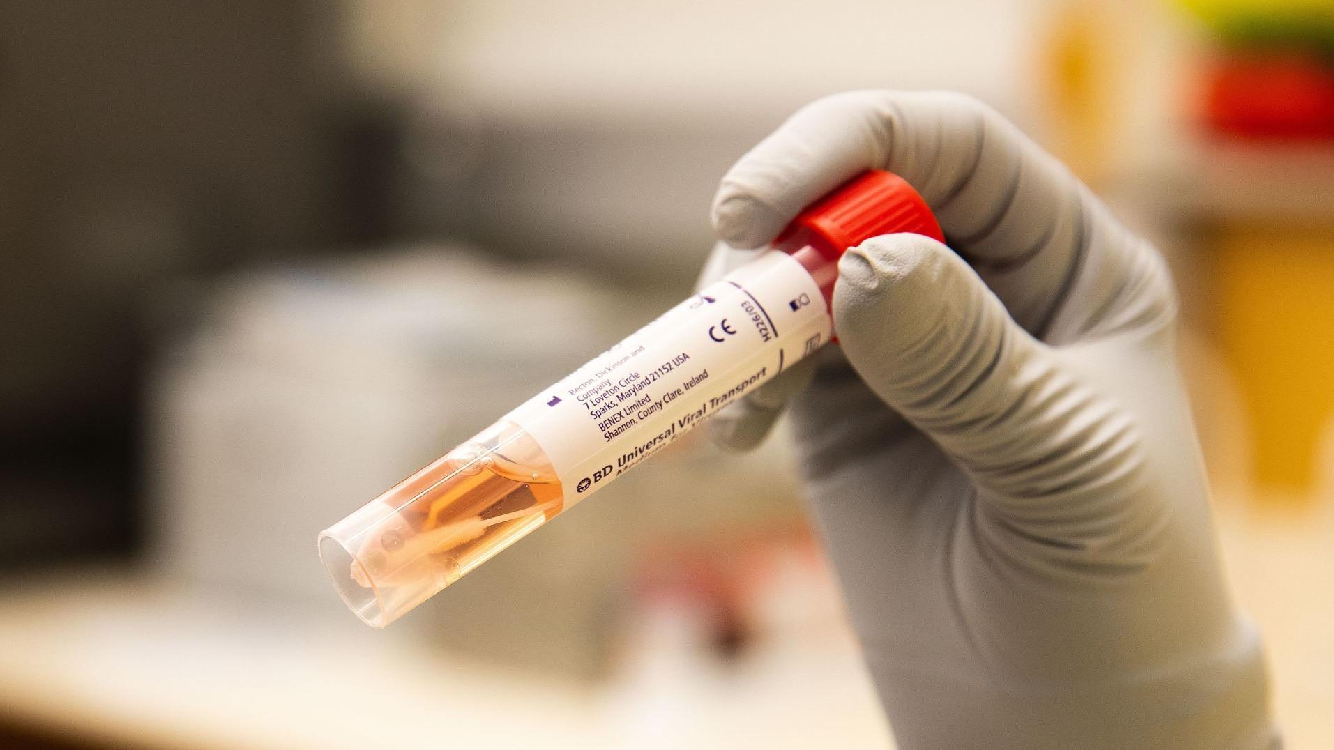 UNMC helping to test whether oral drug can prevent COVID